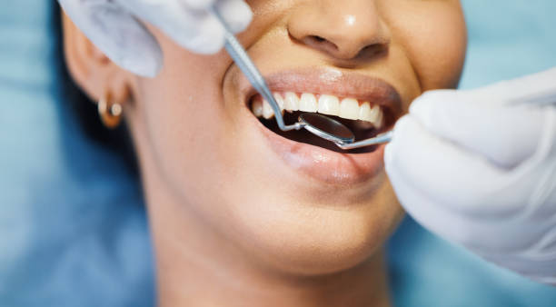 Best Cosmetic Emergency Dentistry in Rock Springs, WY
